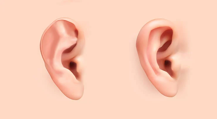 Unlocking Confidence: The Transformative Power of Ear Reshaping Surgery